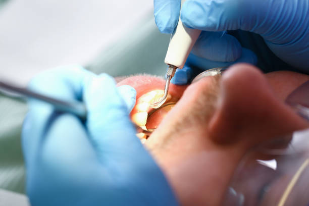 Best Emergency Broken Tooth Repair in Rahway, NJ