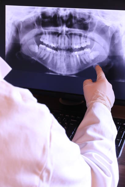 Best Emergency Tooth Extraction in Rahway, NJ